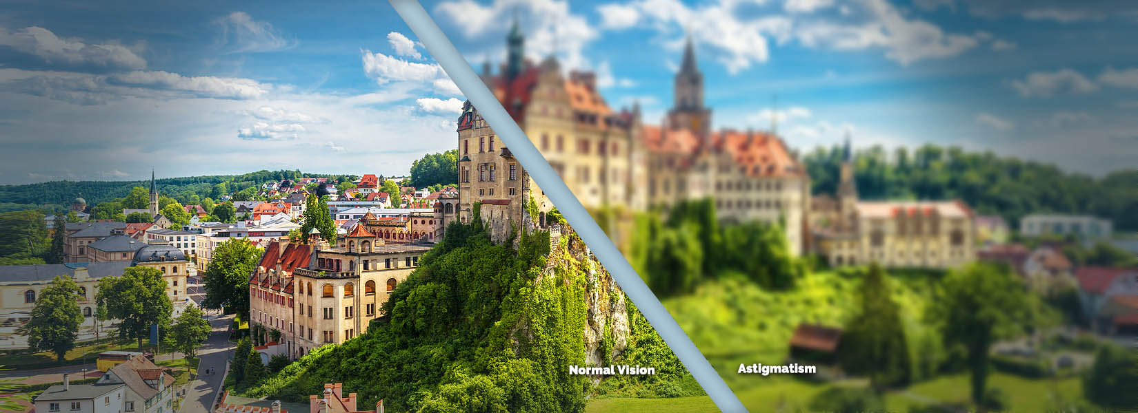 Astigmatism Treatment in Stow