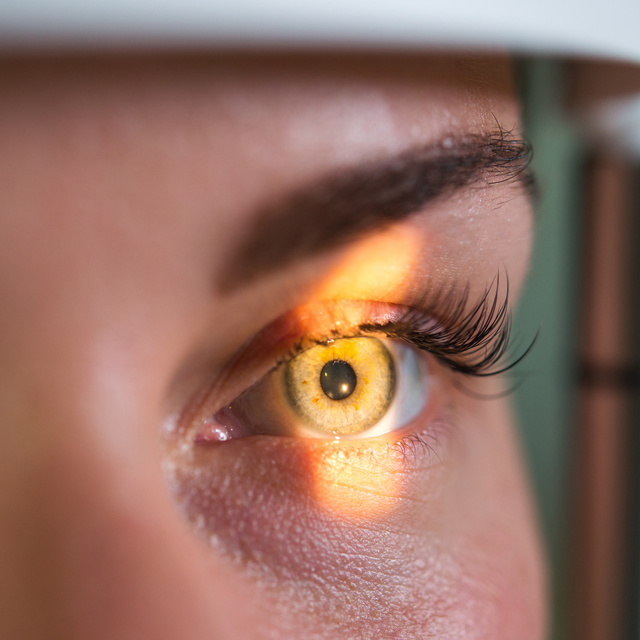 Vision Therapy in Stow